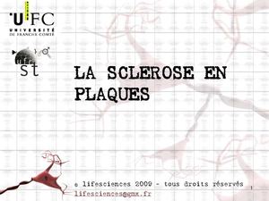 Diaporama de présentation de la sclérose en plaques