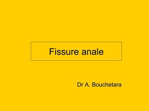 Fissureanale