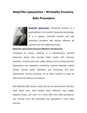 BodyTite Liposuction - Minimally Invasive, Safe Procedure