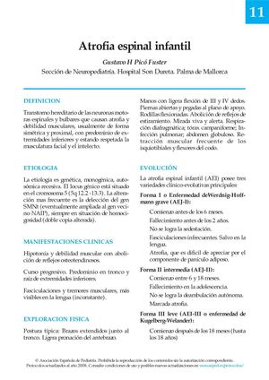 Atrofia espinal infantil 