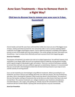 Acne Scars Treatments – How to Remove Acne Scars