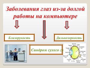 Упражнения для глаз
