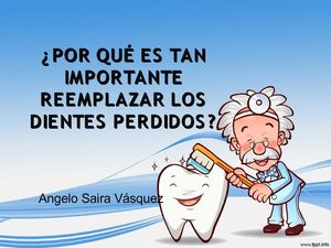 ¿Por Qué Es Tan Importante Reemplazar Los Dientes Perdidos?