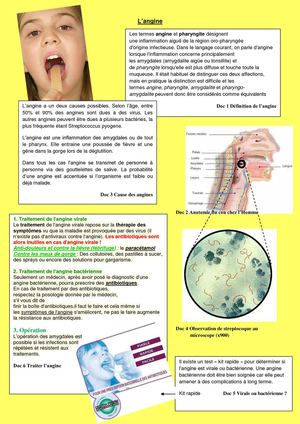 L'angine