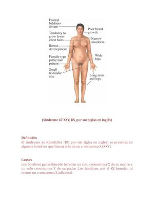 Síndrome de Klinefelter.