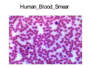 human blood smear