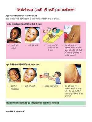 job aid- Classification of Dehydration