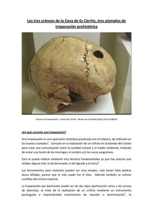 Los tres cráneos de la Cova des Càrritx, tres ejemplos de trepanación prehistórica