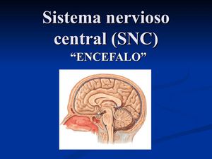 SNC