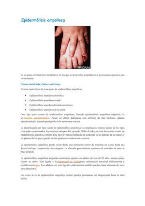 EPIDERMOLISIS AMPOLLOSA