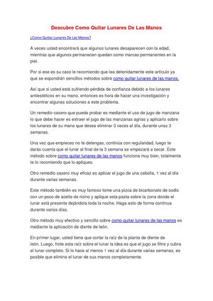 Descubre Como Quitar Lunares De Las Manos