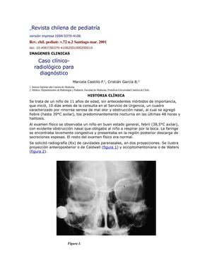 caso clinico de sinusitis