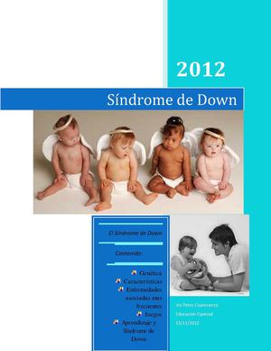 Sindrome de Down