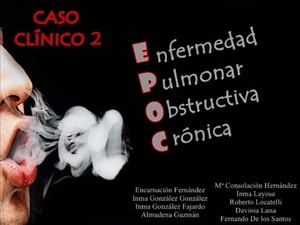 caso 2 epoc power point