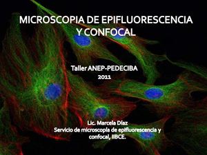 Microscopía de epifluorescencia y confocal