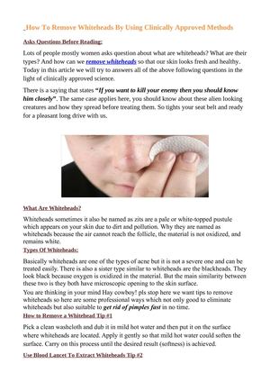 How To Remove Whiteheads - An Extensive Guide!
