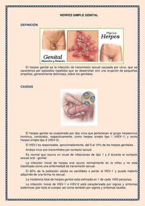 Herpe vaginal