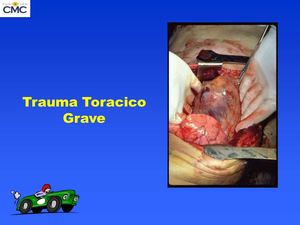 TRAUMA TORACICO GRAVE