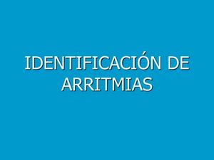 IDENTIFICACION DE ARRITMIAS