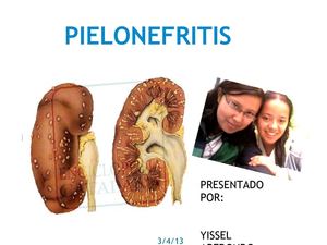 PIELONEFRITIS