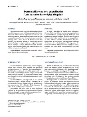 Dermatofibroma con empalizadas 