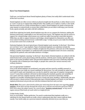 Know Your Dental Implants 