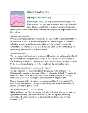 Hives Treatments