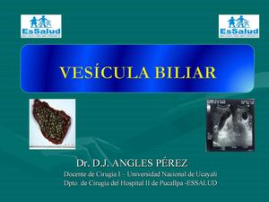 Coledocolitiasis colestasis