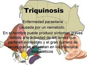 Triquinosis