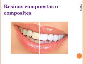 Resinas compuestas o composites