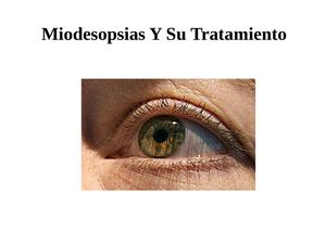 Miodesopsias Tratamientos – Los Más Populares y Efectivos Tratamientos Para Las Moscas En Los Ojos