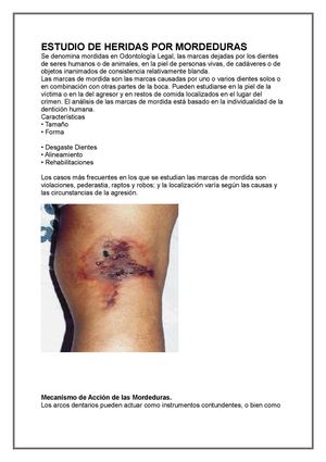 Análisis de Heridas de Mordeduras