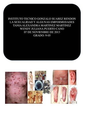 lA SEXUALIDAD Y ALGUNAS ENFERMEDADES