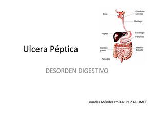 Nurs.232 Ulcera Peptica y Cirrosis