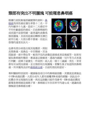 頸部有突出不明腫塊 可能罹患鼻咽癌