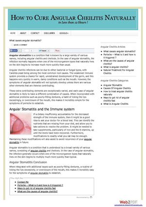 What Causes Angular Stomatitis?