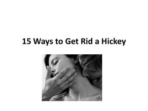 15 Ways to Get Rid a Hickey