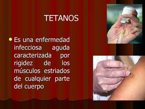 TETANOS