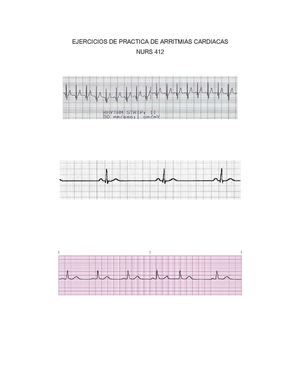 Nurs 412- Ejercicios de Practica para Arritmias Cardiacas