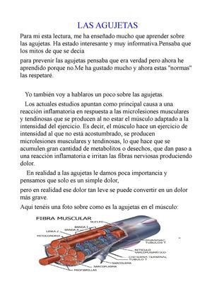 LAS AGUJETAS