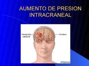 Nurs 412-Monitoreo de Presion Intracraneal