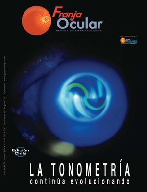 FO Chile, Correcciones