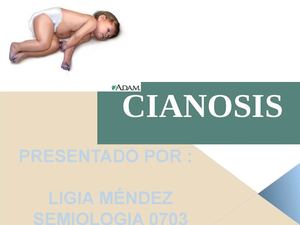CIANOSIS