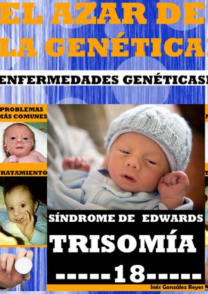 Revista Médica Síndrome de Edwards