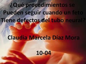 defectos del tubo neural