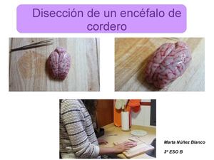 Disección encéfalo (por Marta Núñez)
