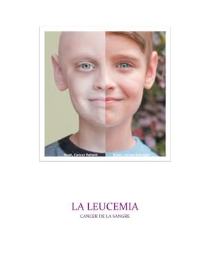 La leucemia Natalia Velasco S.