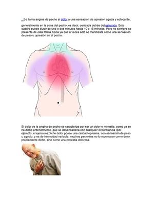 angina de pecho,mas que una enfermedad,un síntoma de dolor