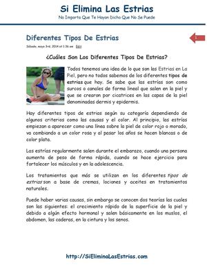 Diferentes tipos de estrias