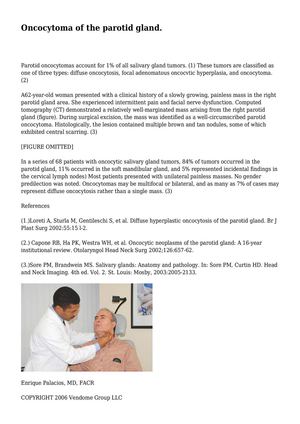 Oncocytoma of the parotid gland.